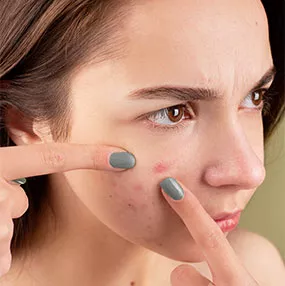 Blemish Removal